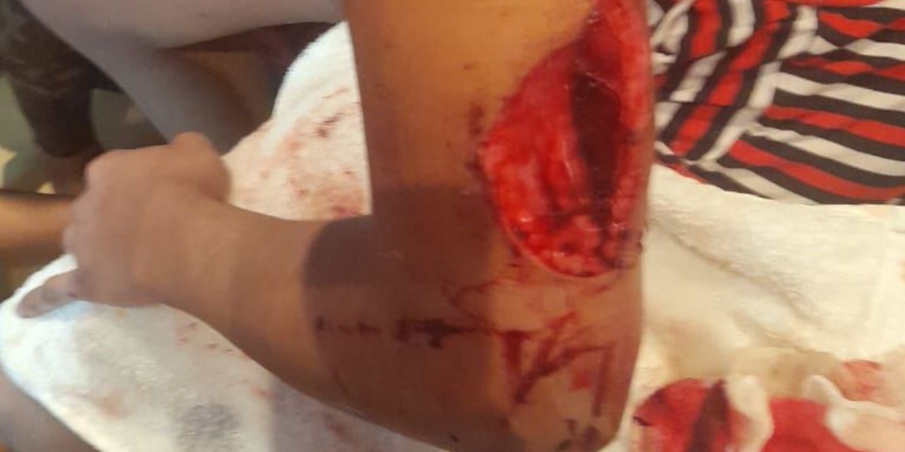 A Pico De Botella Intentan Asesinar A Mujer Trans Centro Psico Trans