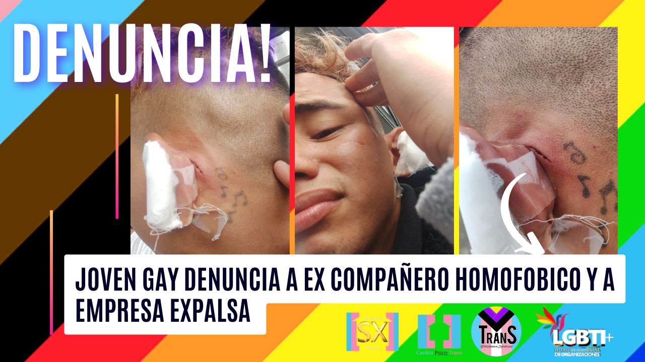 Joven Gay Denuncia Su Presunta Separacion Injusta De Expalsa S.a. Luego Que Un Homofobico De La Empresa Casi Le Arranca La Oreja 3
